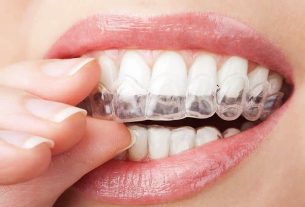 How a good dental clinic can improve your social life