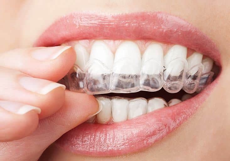 How a good dental clinic can improve your social life